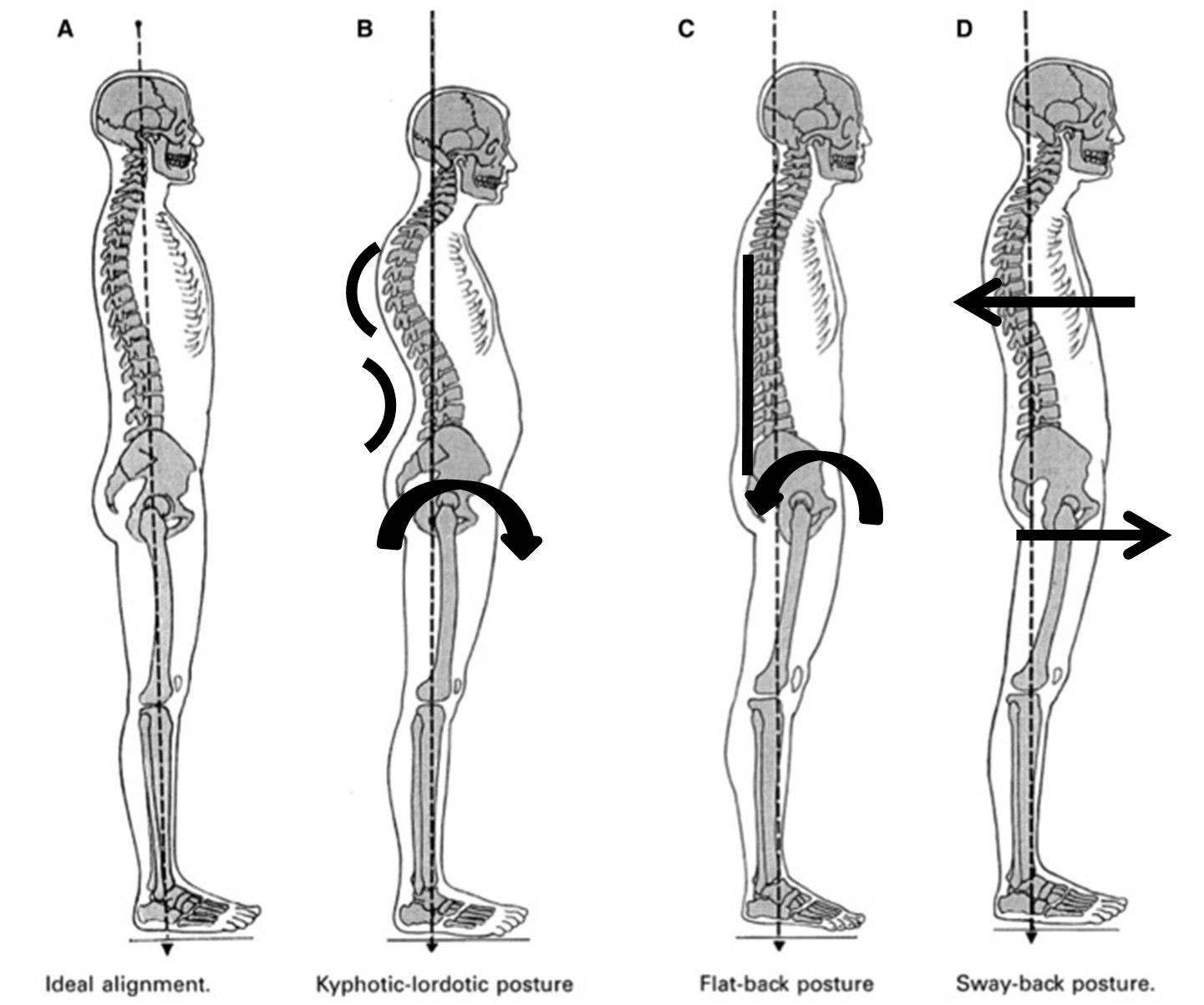 POSTURE – WHY IT’S IMPORTANT & HOW TO IMPROVE YOURS | Paddy Coary Pilates